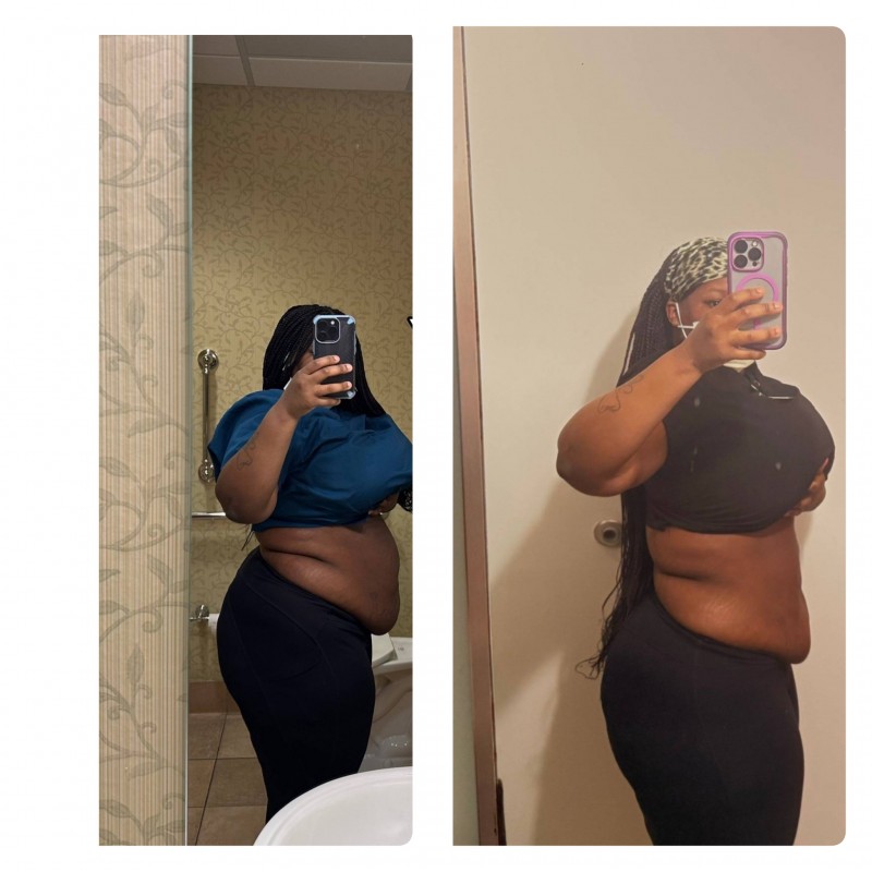 Weight Loss Transformation 2